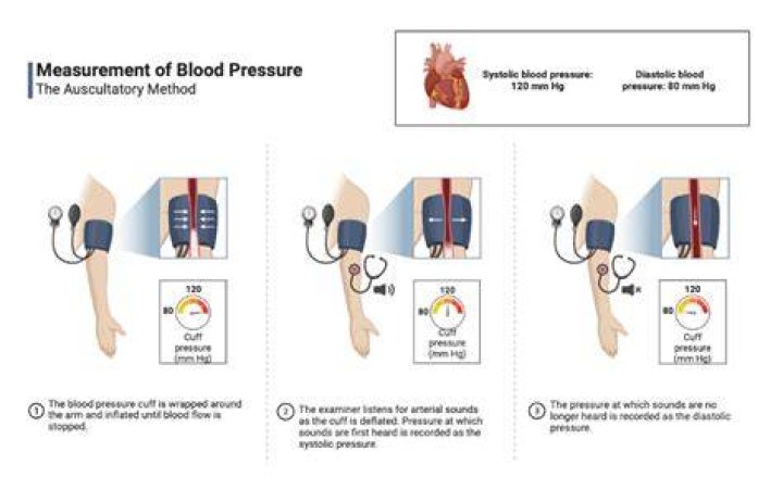 What is auscultatory blood pressure?